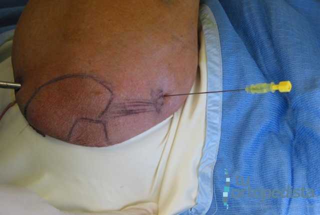 Imagen 11