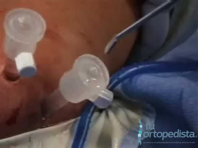 Imagen 12
