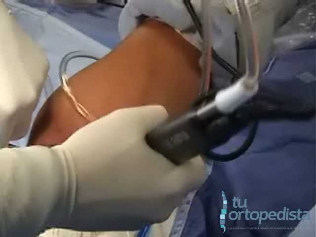 Imagen 13