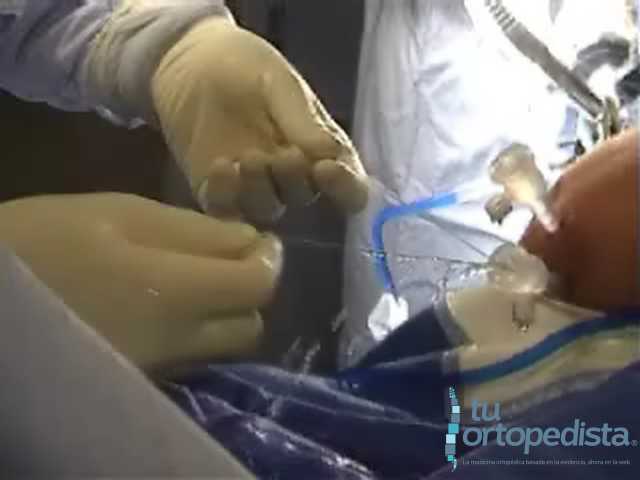 Imagen 14