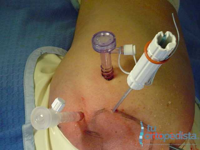 Imagen 16