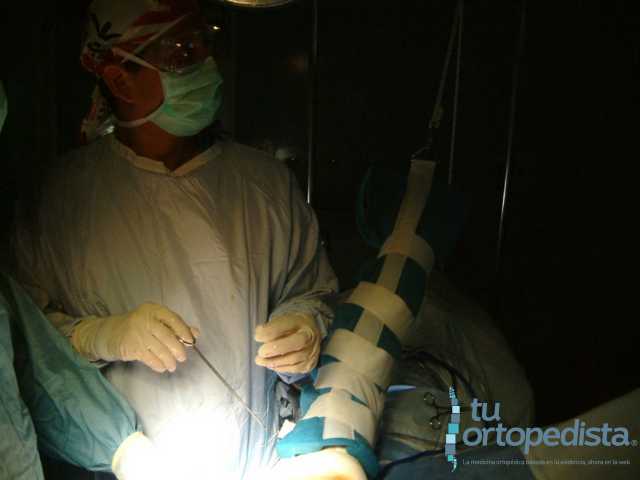 Imagen 17