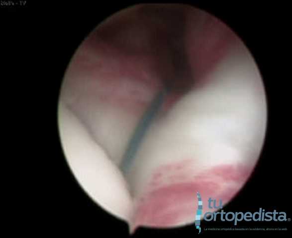 Imagen 19