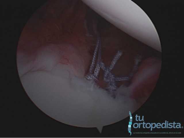 Imagen 19
