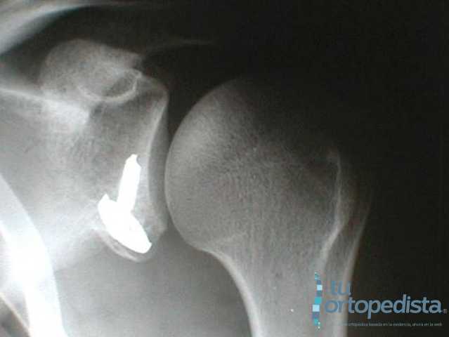Imagen 19