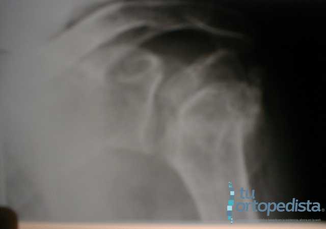 Imagen 19