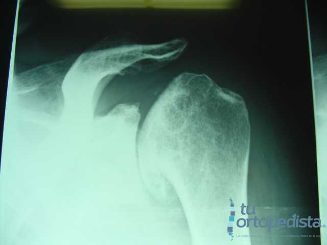 Imagen 19