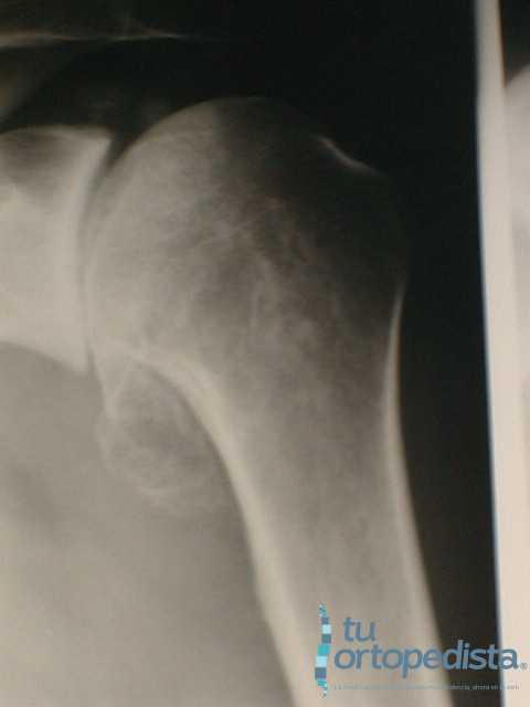 Imagen 19