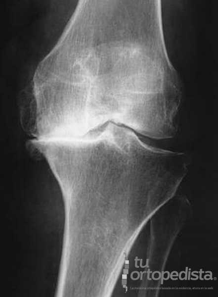 Imagen 18