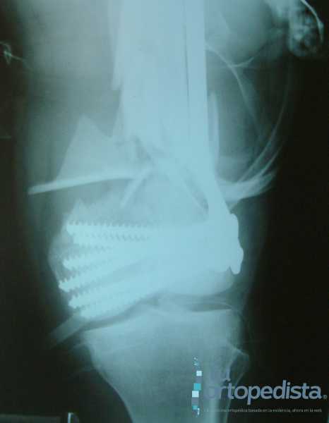 Imagen 18