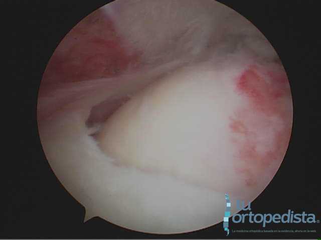 Imagen 18