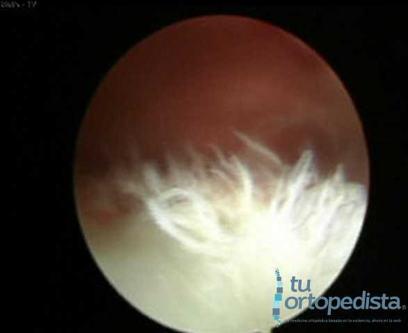 Imagen 18