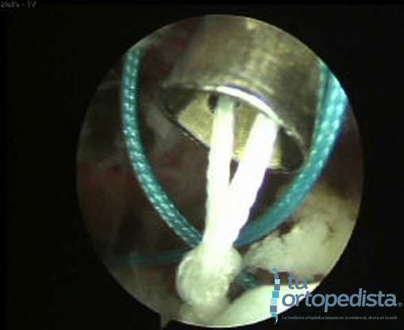 Imagen 19